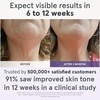 image:imageIllumina Advanced LED Skincare Bundle Face Neck amp Chest AntiAging Mask