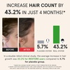 image:imageRegrowth amp Radiance Set Essential Hair Device amp LED Face Mask