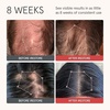 image:imageiRESTORE Red Light Therapy amp Scalp Nourishing Hair Wellness Routine Elite  Thickening Shampoo  Biotin Conditioner  3Item Kit
