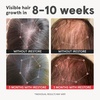 image:imageiRestore Advanced Hair Growth Supplement for Women with Lustriva Hair Vitamins for Faster Hair Regrowth Best for Hair Loss and Thinning 1 Month Supply  1 Count Pack of 1  BlackPack of 1