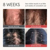 image:imageiRestore Anti Hair Loss and Thinning Shampoo  Biotin Formula for Hair Growth Thickening and Volumizing for Men amp WomenFresh