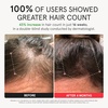 image:imageiRestore Elite  Rechargeable Battery Pack  Laser Red Light Therapy for Hair Growth  FDA Cleared Hair Loss Hair Thinning Treatment for Men amp Women  Hair Regrowth Laser Cap  500 Lasers amp LEDsiRESTORE Elite