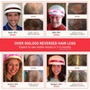 image:imageiRestore Essential  Laser Red Light Therapy for Hair Growth  FDA Cleared Hair Loss Hair Thinning amp Alopecia Treatment for Men amp Women  Laser Cap for Hair Regrowth Stimulate Denser Fuller HairiRESTORE Essential Plus Battery