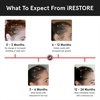 image:imageiRestore Essential  Laser Red Light Therapy for Hair Growth  FDA Cleared Hair Loss Hair Thinning amp Alopecia Treatment for Men amp Women  Laser Cap for Hair Regrowth Stimulate Denser Fuller HairiRESTORE Essential Plus Battery