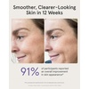 image:imageiRestore Face Mask Pro 8Wavelength Red Light Therapy for Face 800 DiodesFace Mask Pro