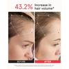image:imageiRestore Professional Laser Red Light Therapy for Hair Growth System  FDA Cleared Hair Loss Hair Thinning amp Alopecia Treatment for Men amp Women  282 Lasers amp LEDsProfessional  Battery Pack