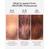 image:imageiRestore Professional Laser Red Light Therapy for Hair Growth System  FDA Cleared Hair Loss Hair Thinning amp Alopecia Treatment for Men amp Women  282 Lasers amp LEDsiRestore Professional