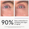 image:imageiRestore Red Light Therapy for Eyes  180 LEDs Eye Mask with Infrared Light for UnderEye Wrinkles Forehead Lines 11s Crows Feet Dark CirclesWhite